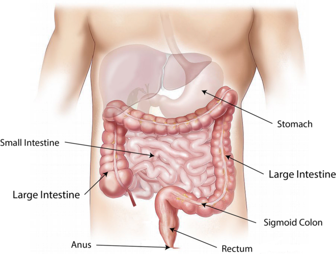 enfermedad de crohn, dieta para la enfermedad de Crohn, diarrea, dieta, salud