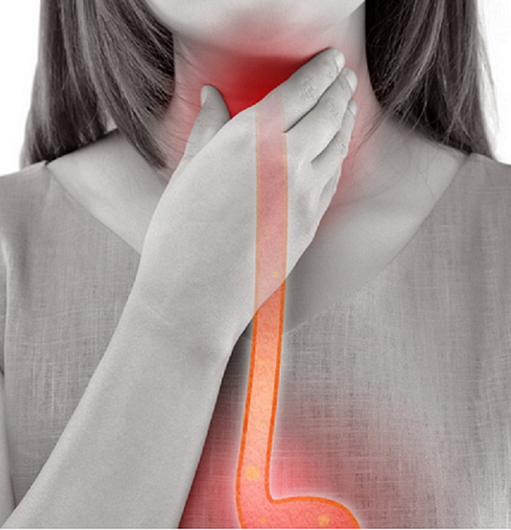 Hernia de hiato, causas, síntomas y tratamiento, dieta para hernia de hiato, dietista online, dietas online