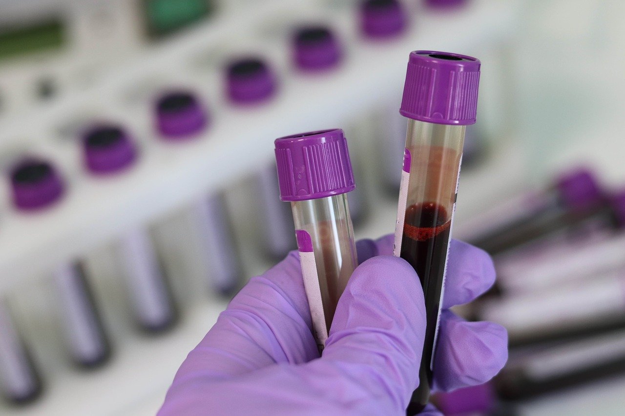 Test de riesgo de diabetes, diabetes, diabetes I, diabetes II, diabetes gestaciional, diabetes tipo I, insulina, diabetes tipo II
