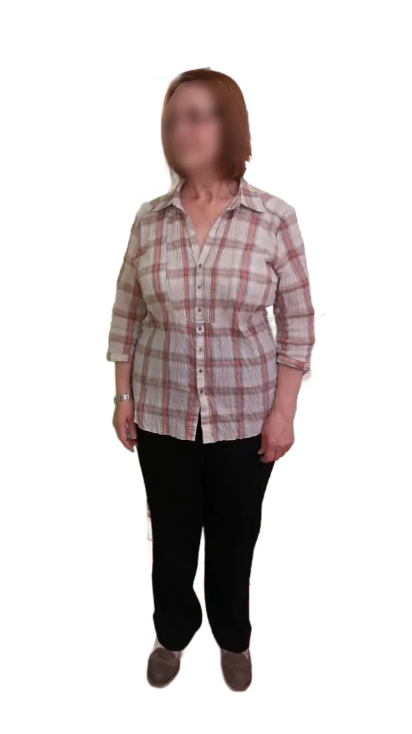 Antes y después, casos de exito, adelgazar rápido, quiero perder peso