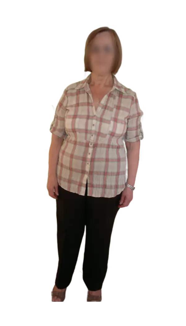 Antes y después, casos de exito, adelgazar rápido, quiero perder peso