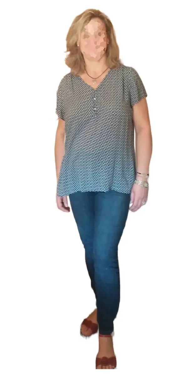 Antes y después, casos de exito, adelgazar rápido, quiero perder peso