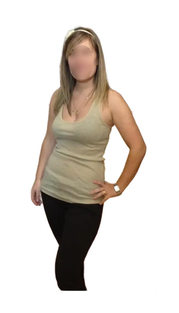 Antes y después, casos de exito, adelgazar rápido, quiero perder peso