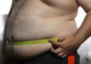 c&oacute;mo empezar a perder peso con obesidad de forma realista