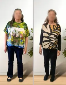 Comparativa antes y después de mujer tras proceso de mejora de hábitos alimentarios con acompañamiento nutricional profesional.