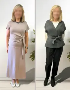 Comparativa antes y después de mujer tras proceso de reeducación alimentaria con seguimiento nutricional profesional.