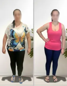 Comparativa antes y después de mujer tras proceso de cambio de hábitos con seguimiento nutricional profesional.