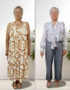 Comparativa antes y después de mujer tras proceso de mejora de hábitos con acompañamiento nutricional profesional.
