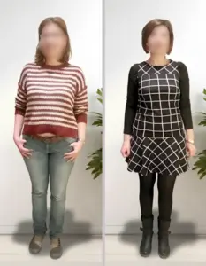 Comparativa antes y después de mujer tras proceso de reeducación alimentaria con seguimiento nutricional profesional.