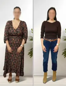 Comparativa antes y después de mujer tras proceso de mejora de hábitos con acompañamiento nutricional profesional.