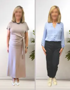 Comparativa antes y después de mujer tras proceso de reeducación alimentaria con seguimiento nutricional profesional.